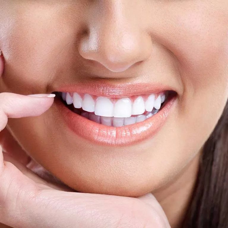 Veneers & Cosmetic Dentistry Services